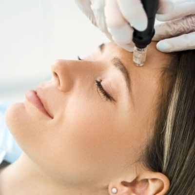 anti-aging-all-you-need-to-know-about-microneedling-technique